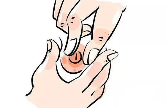 乳头内陷,不可忽视!_医学界-助力医生临床决策和职业成长