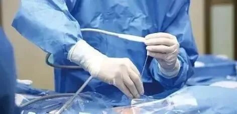 氦氩刀是什么【科普】“氩氦刀”是什么刀？_https://www.jmylbn.com_新闻资讯_第4张