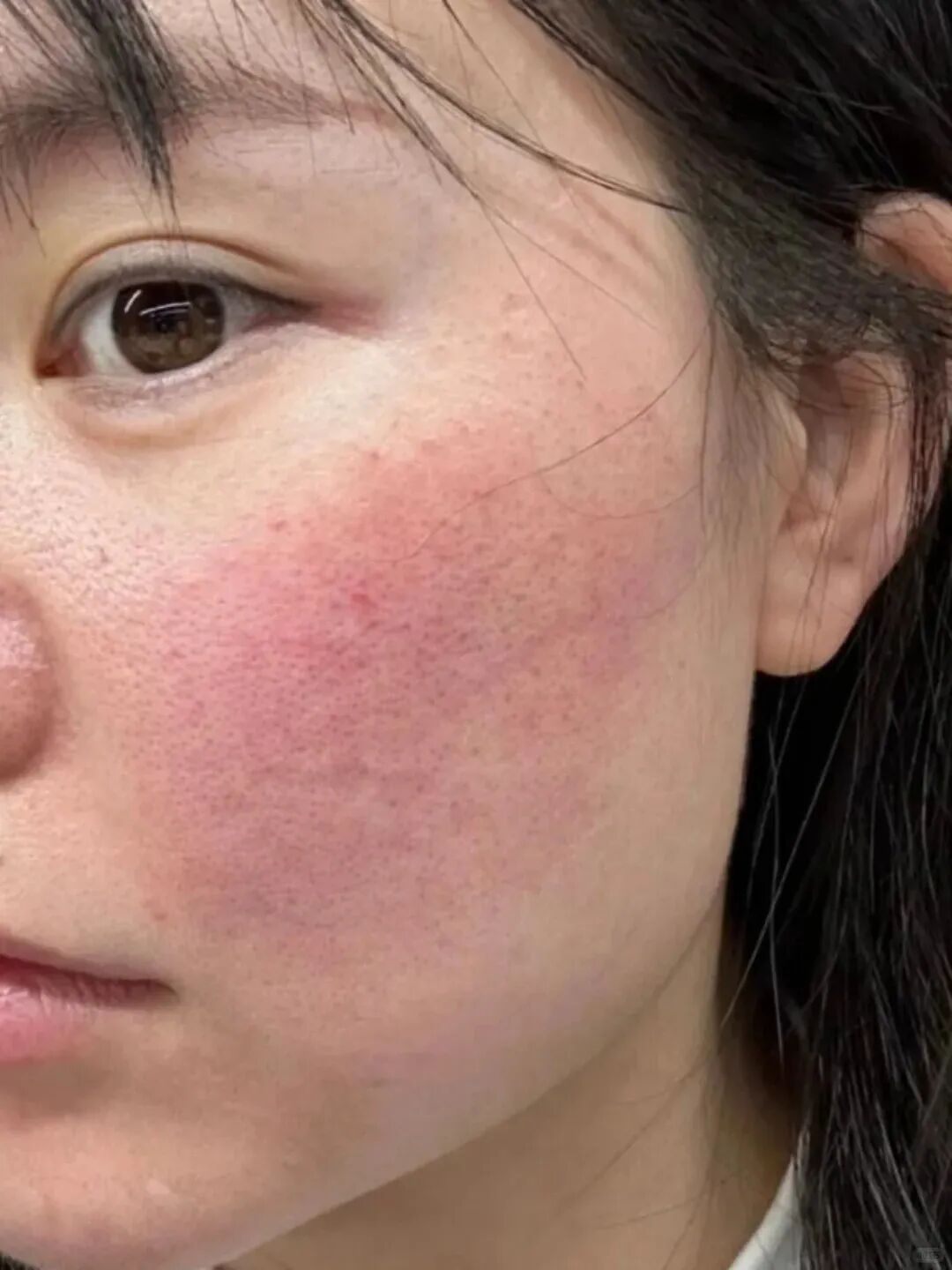一年之肌在于春乐草元植萃焕发勃勃生肌