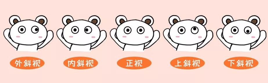 弄明白这几个问题，你才真正正确认识斜视！
