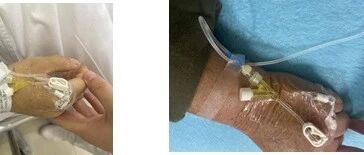 这个针，病房护士真不能随便打！