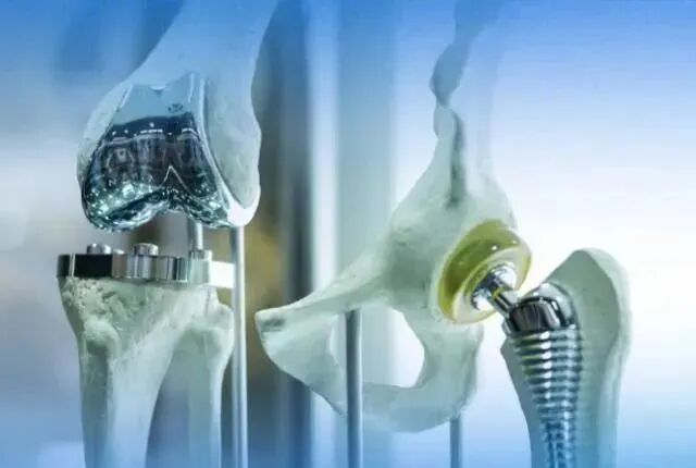 骨科什么耗材比较好卖好消息！国家集采骨科耗材在荣昌棠城、康弗尔医院落地，平均降价逾80%！人工关节正式进入“千元时代”_https://www.jmylbn.com_新闻资讯_第6张