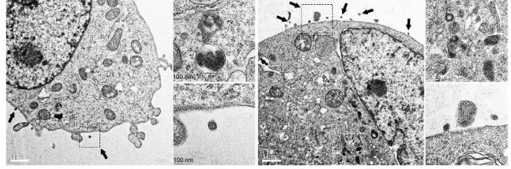 引流器排泄怎么用Research｜四川大学高会乐教授团队脑靶向纳米递药系统的脑排泄机制新进展_https://www.jmylbn.com_新闻资讯_第5张