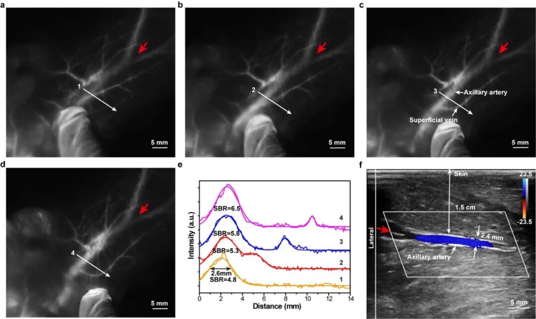唐本忠院士团队：聚集诱导发光新突破，首次在非人灵长类动物实现1.5厘米深腋动脉血管近红外二区荧光成像的图6