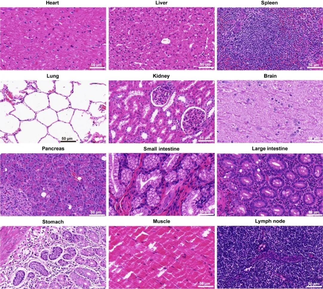 唐本忠院士团队：聚集诱导发光新突破，首次在非人灵长类动物实现1.5厘米深腋动脉血管近红外二区荧光成像的图4