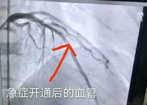 国庆假期，千万别做这5件“傻事”！小心大病找上你！