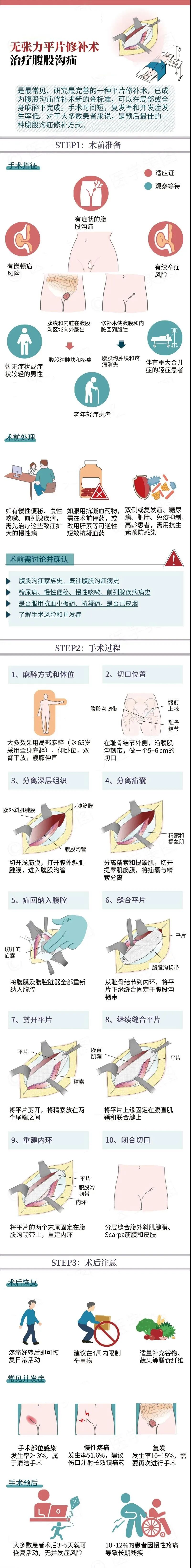疝气 片是什么图说无张力平片修补术治疗腹股沟疝_https://www.jmylbn.com_新闻资讯_第1张