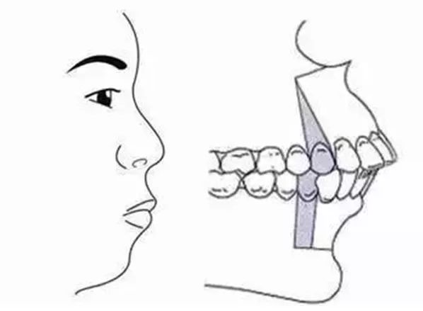 你的牙齿整齐吗？