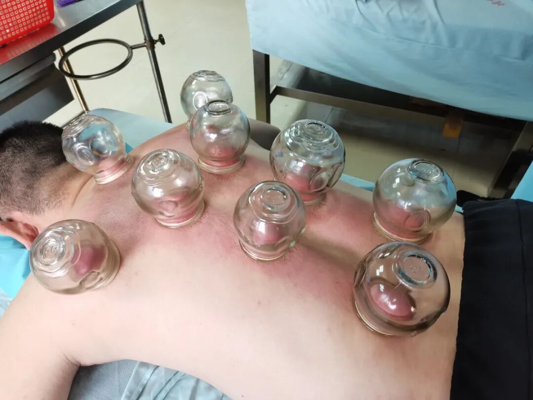 康复治疗激光怎么收费止痛“硬核”设备 ｜ 我院针灸康复科引进超激光疼痛治疗仪，快来了解一下吧！_https://www.jmylbn.com_新闻资讯_第13张