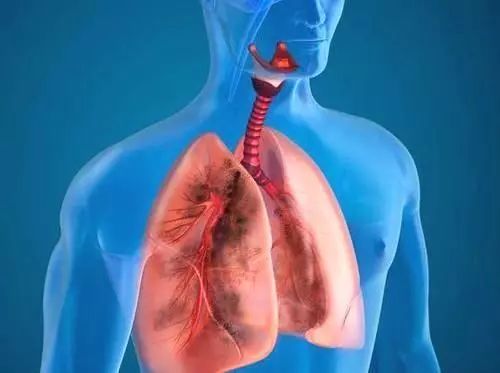 肺部结节 肺部结节