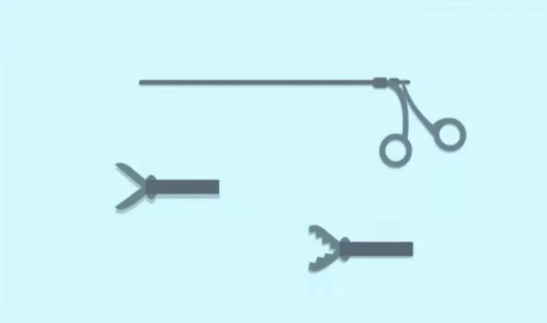 b膀胱镜为什么消毒泌尿外科迈向微创时代新“镜”界——膀胱镜_https://www.jmylbn.com_新闻资讯_第14张