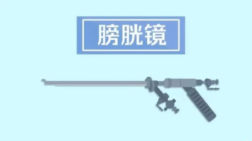 b膀胱镜为什么消毒泌尿外科迈向微创时代新“镜”界——膀胱镜_https://www.jmylbn.com_新闻资讯_第17张