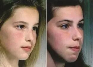 怎么区别呼吸用鼻子呼吸和用嘴呼吸，到底有什么区别？一张图片道出了真相_https://www.jmylbn.com_新闻资讯_第2张