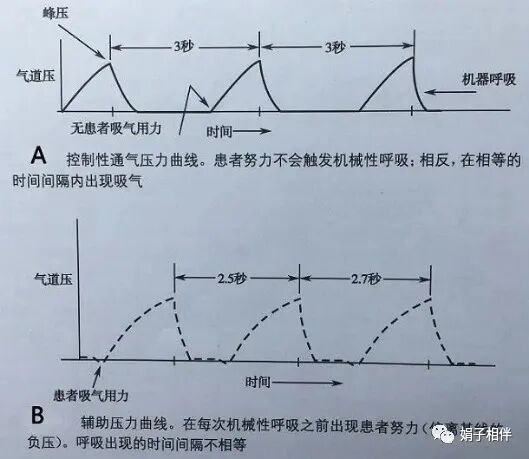 呼吸机呼吸怎么写呼吸机使用指南：让护士碰到呼吸机参数不再慌！_https://www.jmylbn.com_新闻资讯_第9张