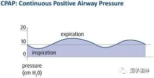 为什么呼吸机人机同步【二院护理】呼吸机的常用模式和使用!_https://www.jmylbn.com_新闻资讯_第15张