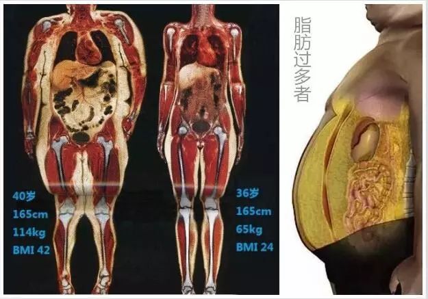 三高、瘦身界的「谷物冠軍」，每天1碗，降糖控壓防便秘，讓你一月吃瘦10斤，連澳洲總理都推薦！ 健康 第3張