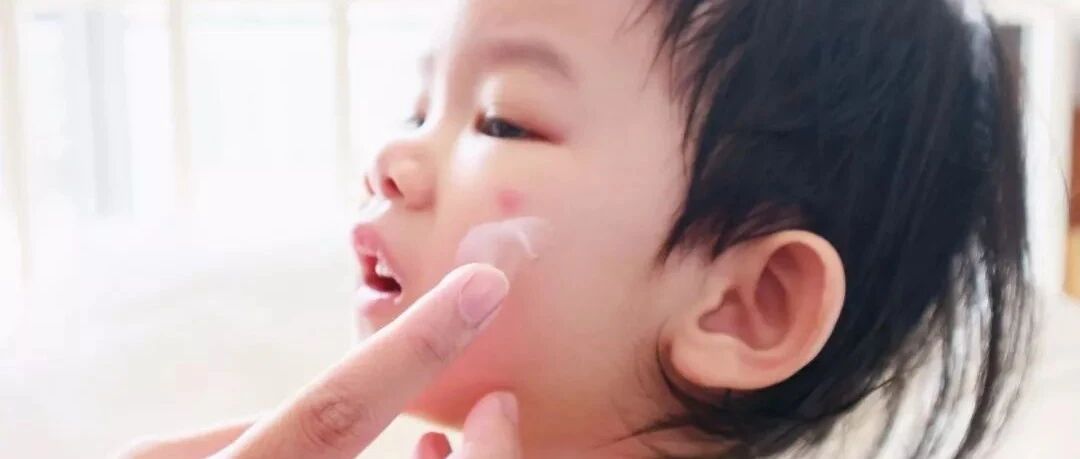 手上长透明小水泡？当心是身体发出的求救信号！