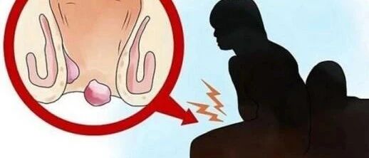 这种羞羞的病，50%的成年人都有过，越早预防越好