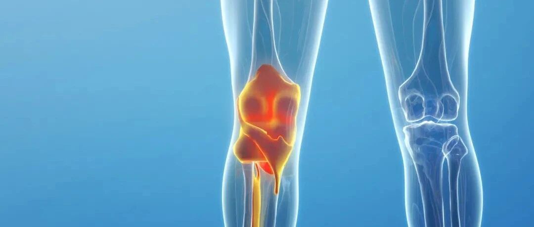 “老寒腿”是不穿秋裤冻出来的？秋裤：这锅我不背