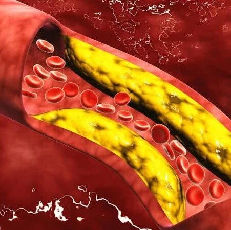血压、血糖、血脂、尿酸标准对照表，忌口清单全都有