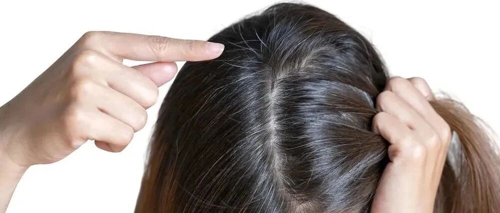 越来越多年轻人长白头发，究竟是什么原因引起的？