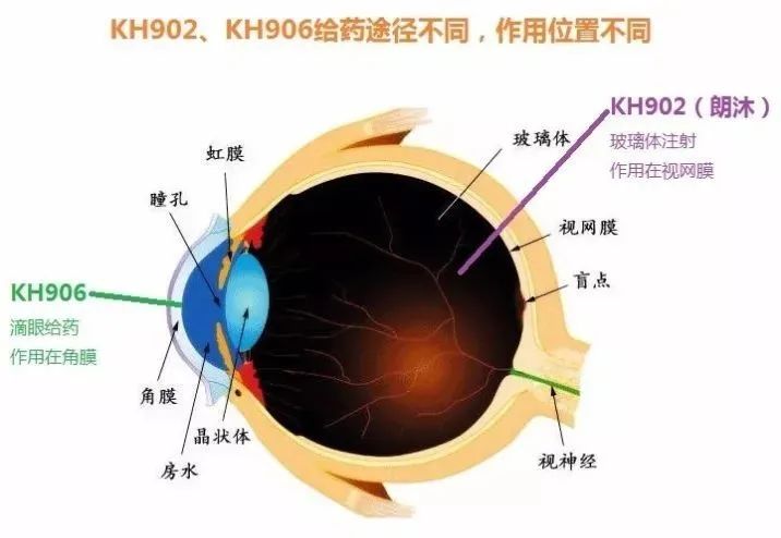 Vegf融合蛋白演化 阿柏西普之后 康柏西普 Ibi302 Rc28跟踪式开发 生物制药小编 微信公众号文章阅读 Wemp