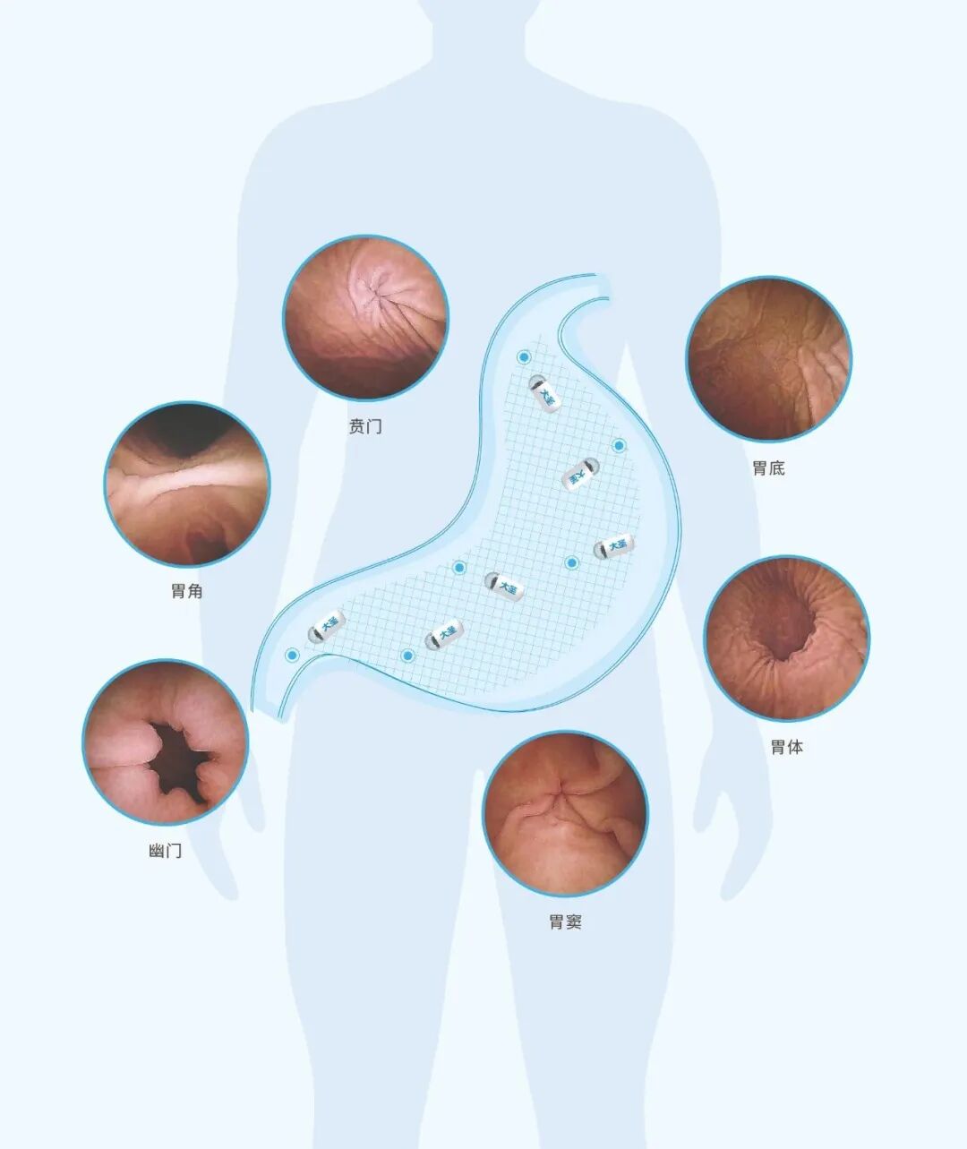 胃镜有哪些型号胃镜、肠镜、胶囊内镜—6种消化内镜介绍_https://www.jmylbn.com_新闻资讯_第2张