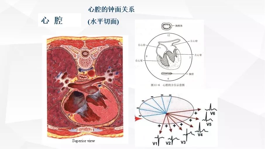 一文詳解：急性心肌梗死的判讀！ 未分類 第8張