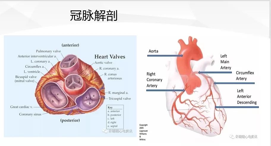 一文詳解：急性心肌梗死的判讀！ 未分類 第10張