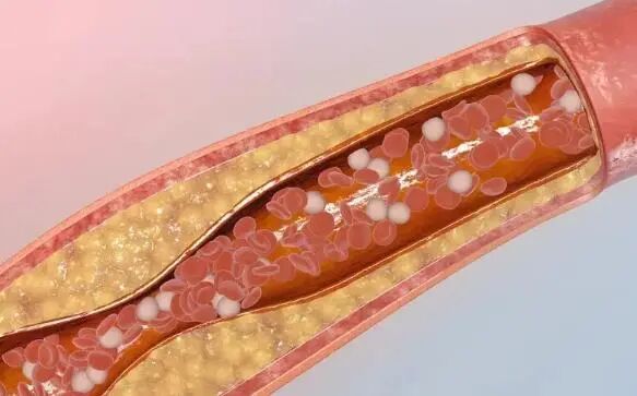 水洗蛋白怎么测医生提醒：请停止食用“水洗蛋”，或比喝酒伤肝，别不当回事_https://www.jmylbn.com_新闻资讯_第9张