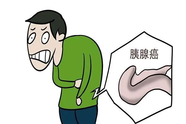 胰腺癌难治、容易转移，影响因素是什么？胰腺癌早期有何征兆？