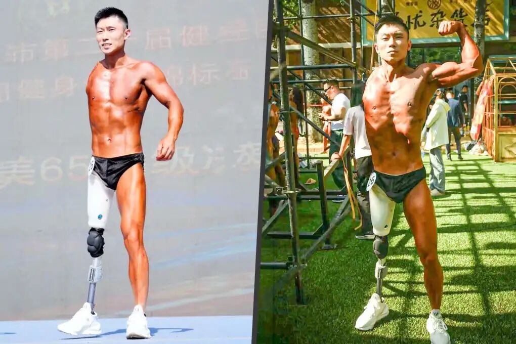 A Chinese man who lost a leg and an arm inspires many by competing in bodybuilding, earning massive admiration. Photo: SCMP composite/Douyin