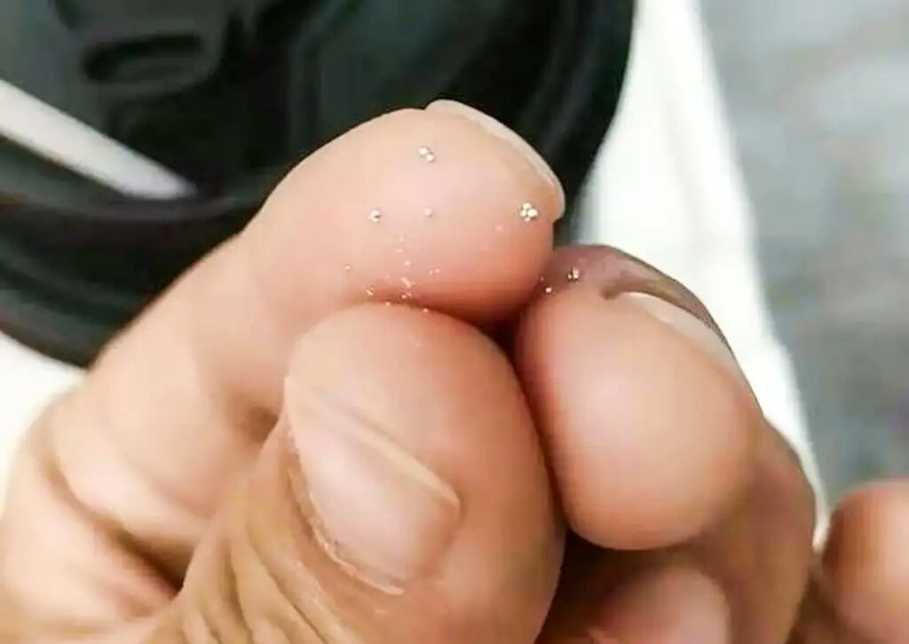 The woman found tiny metal slivers, like those above, in her cup of tea. Photo: Weibo