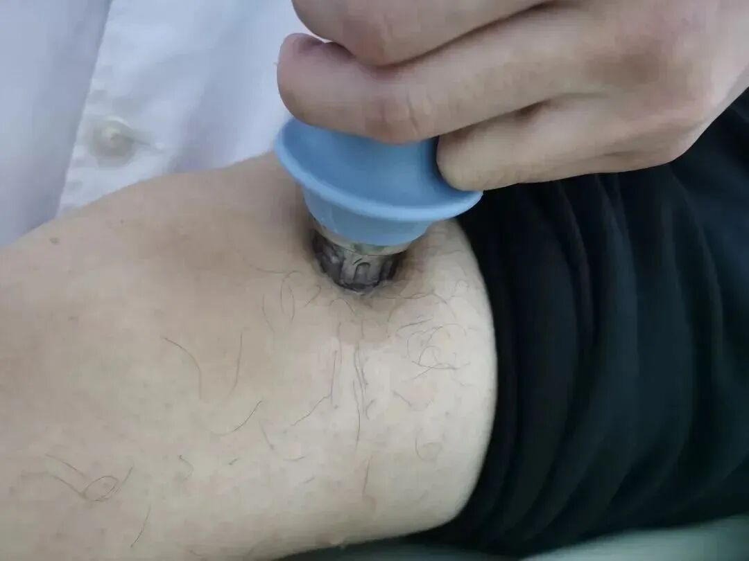 四肢联动怎么使用康复要去哪里做？连江县中医院康复医学科已正式投入使用……_https://www.jmylbn.com_新闻资讯_第2张