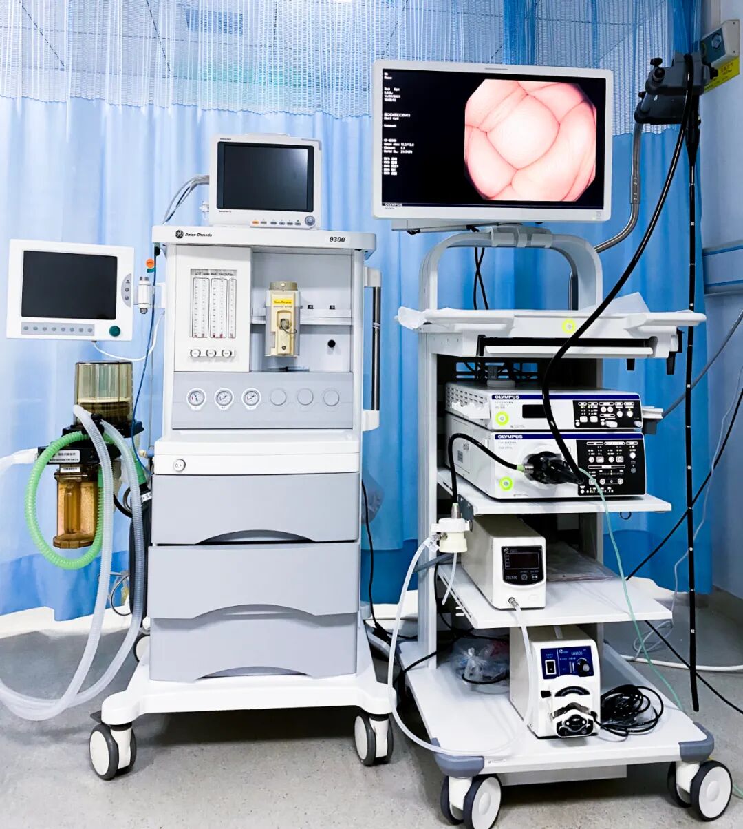 奥林巴斯胃肠镜怎么做精益求精，镜善镜美——我院引进“消化道保护神”奥林巴斯290电子胃肠镜系统_https://www.jmylbn.com_新闻资讯_第4张