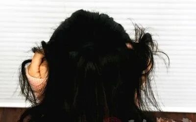 洗头掉很多头发是什么原因导致掉发的原因