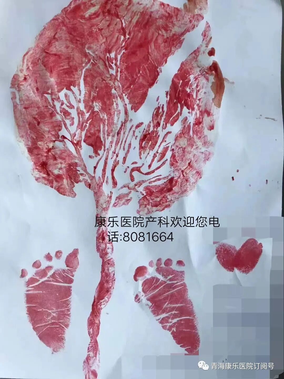 剪脐带用什么剪刀为生命“剪彩”！准爸爸亲手为“宝宝剪脐带” 剪出幸福与责任_https://www.jmylbn.com_新闻资讯_第10张