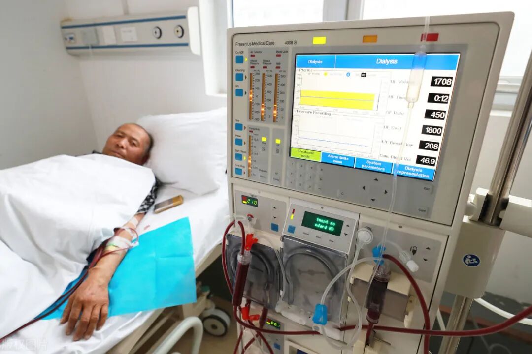 甚至还有人,直接让肌酐高的患者回家等透析,这是有多大仇多大怨.