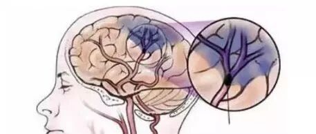 血管的四大守护神，原来如此朴素……