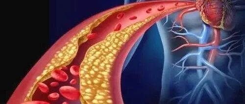 这样一碗粥，清血溶栓，血液畅通无阻