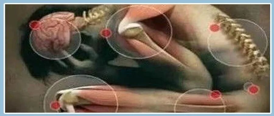 身体的语音：疼痛对照表！准的吓人！