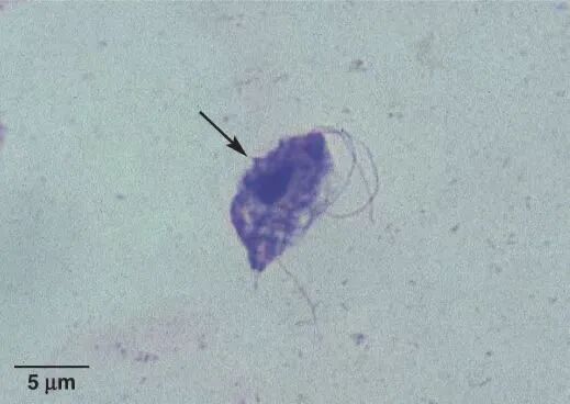 犬猫贾第鞭毛虫病会感染人吗如何预防