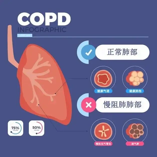 呼吸机怎么制氧慢阻肺患者为什么使用呼吸机还需制氧机？_https://www.jmylbn.com_新闻资讯_第1张