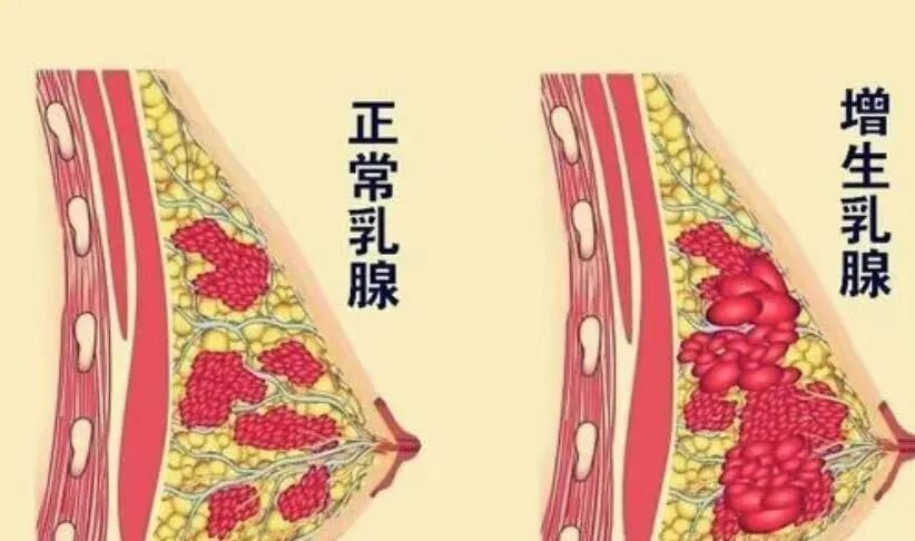 中医定向透药用什么药【特色诊疗推介】中医定向透药+辩证自拟方治疗乳腺增生_https://www.jmylbn.com_新闻资讯_第2张