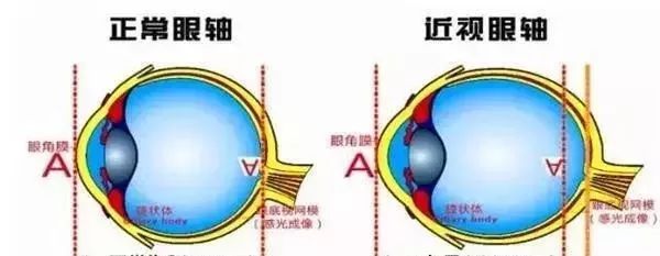 寒假期间！预防近视应该怎么做？？？