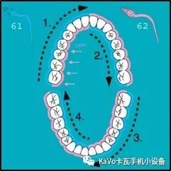 气动洁牙机怎么样卡瓦 SONICflex 气动洁牙机--多功能工作尖_https://www.jmylbn.com_新闻资讯_第29张