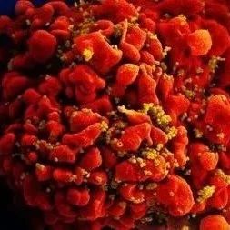 研究人员记录了第三个干细胞移植的HIV缓解案例