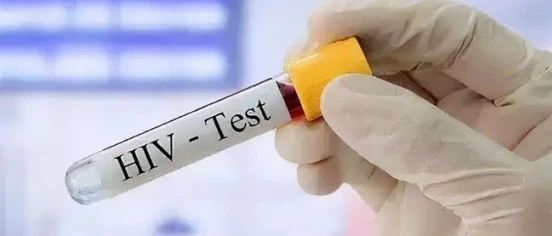 HIV要治疗多久，才能病载“检测不到”？