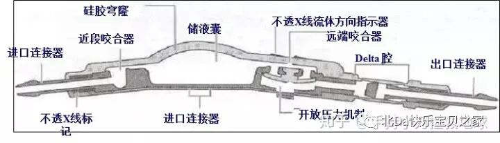 美敦力品牌怎么样各品牌脑室腹腔分流管类型收集及图例_https://www.jmylbn.com_新闻资讯_第5张