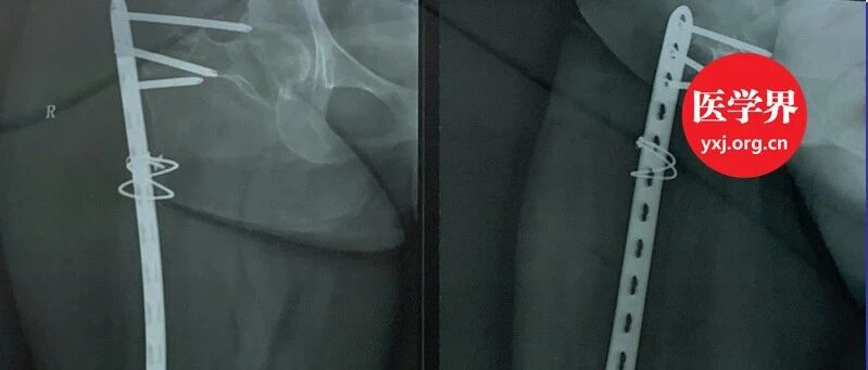 “我愿把自己当人体研究，求医生治疗！”